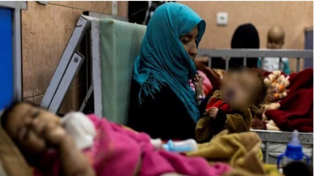 آژانس غذای سازمان ملل متحد: نرخ سوء تغذیه در افغانستان به رکورد بالایی رسید؛